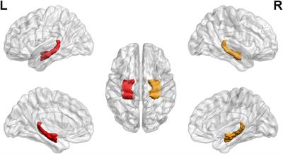 Altered hippocampal functional connectivity after the rupture of anterior communicating artery aneurysm